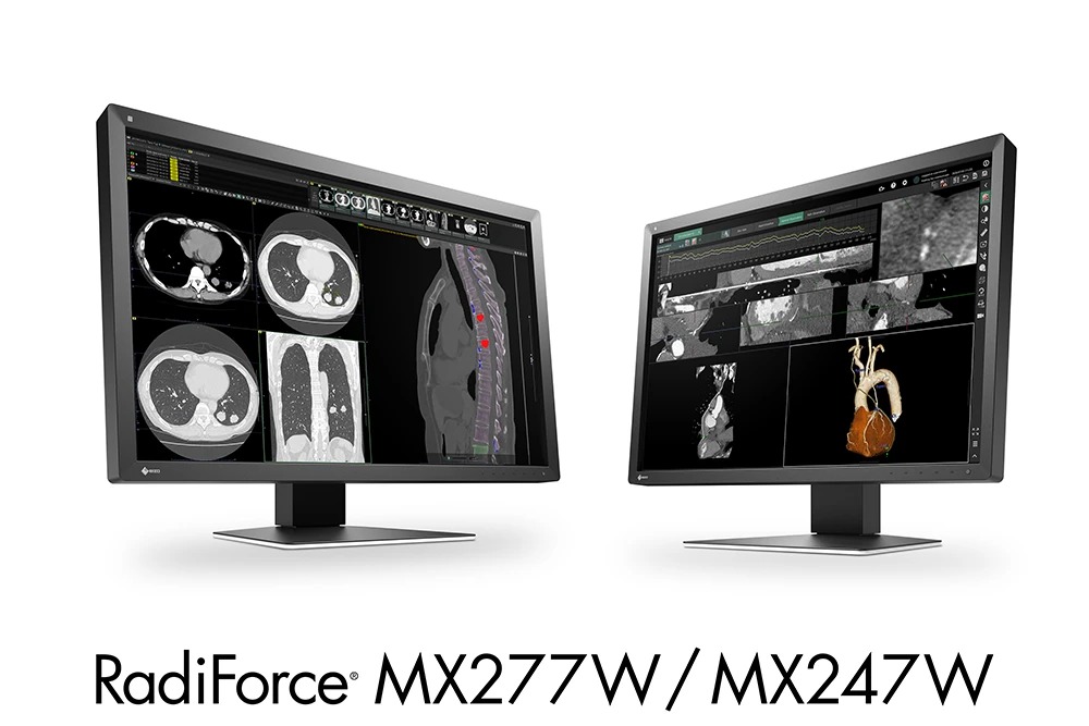 艺卓公布 2 款 RadiForce MX 系列医疗影像显示器,均符合专业灰度标准