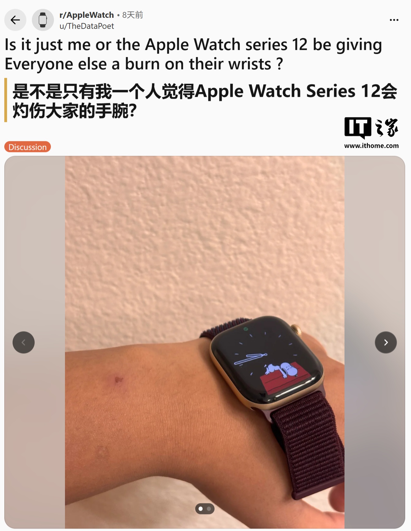 部分苹果 Apple Watch Series 12 智能手表用户报告皮肤刺激情况