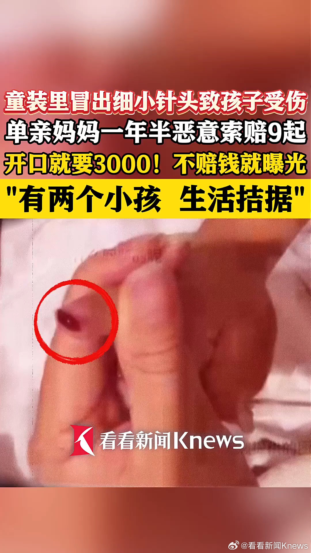 女子 1 年半内 9 次以“童装藏针扎伤孩子”敲诈网店被警方刑拘,涉案金额 3 万余元